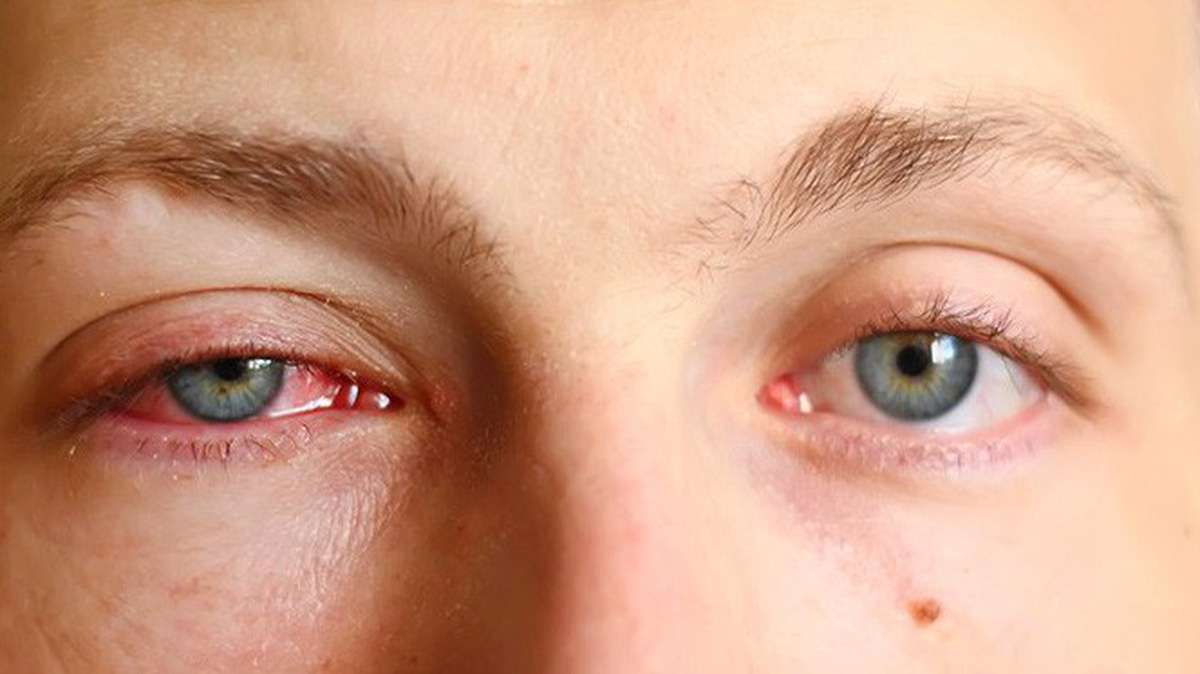 Tác hại nếu độ đồng đều thấp