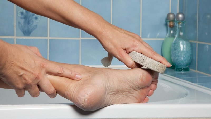 Những vùng da dễ bị lãng quên